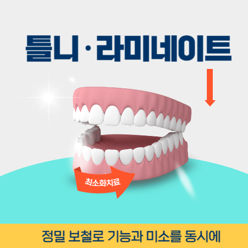 춘천치과 춘천시 치과 틀니 라미네이트