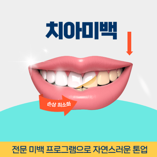 춘천치과 춘천시 치과 치아미백