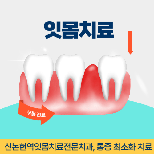 춘천치과 춘천시 치과 잇몸치료